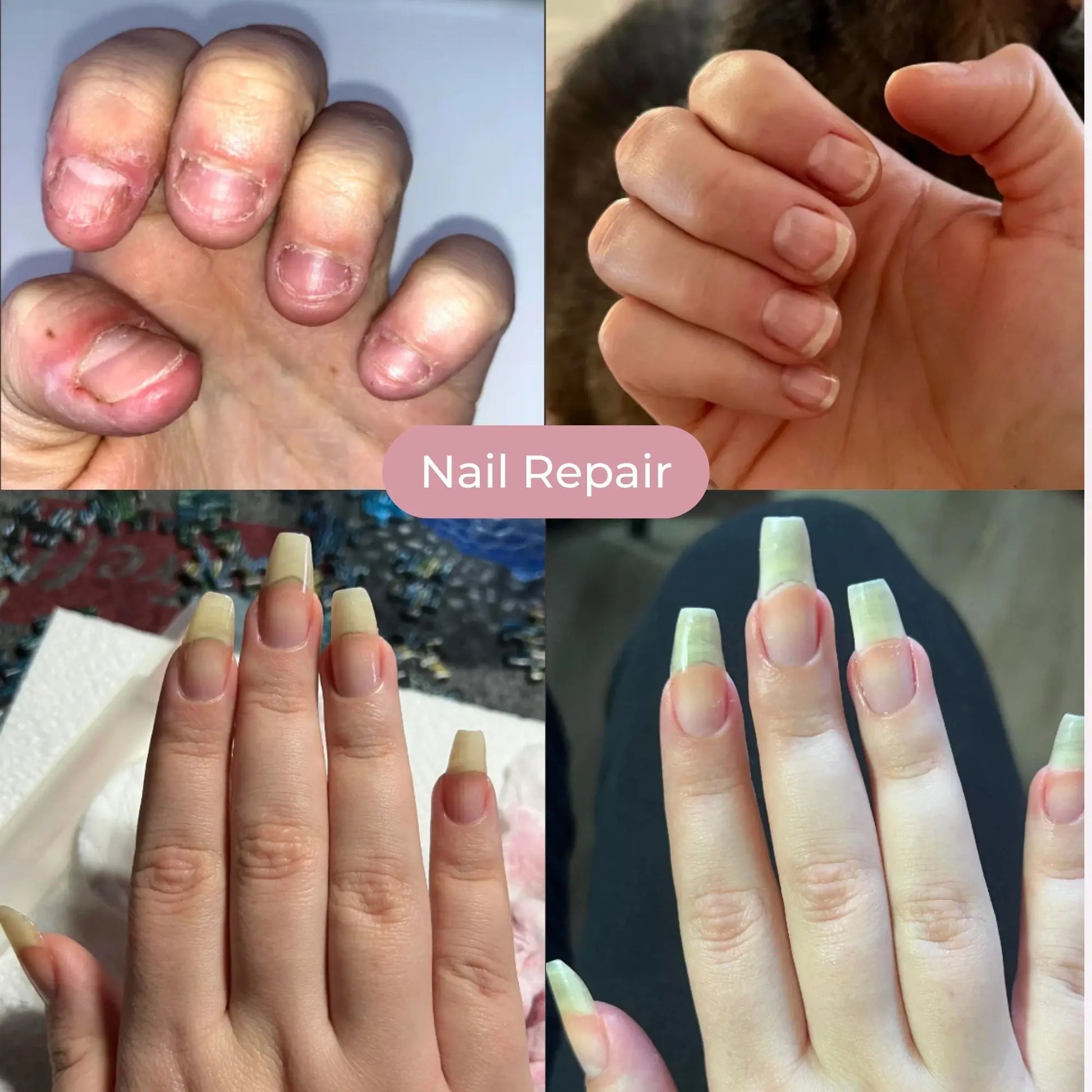 2-Pack Nail Growth Oil Pen — Nourishing Cuticle Oil for Stronger, Healthier Nails